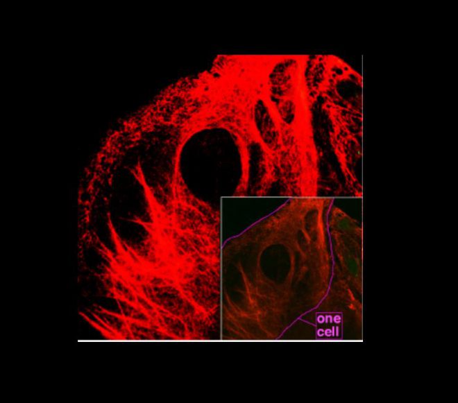 How Does Keratin Treatment Help Your Hair?